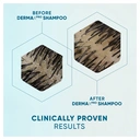 Head & Shoulders DermaXPro Repairing Moisture Anti Dandruff Shampoo With Coconut Oil 300ml image 4