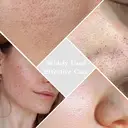 Qiweiny Dual-Mode Blackhead Remover Tools- Skin Scrubber Face Spatula | Battery/Handheld Face Scraper for Deep Cleansing, Skin Care Tool for Men and Women (Green) image 3